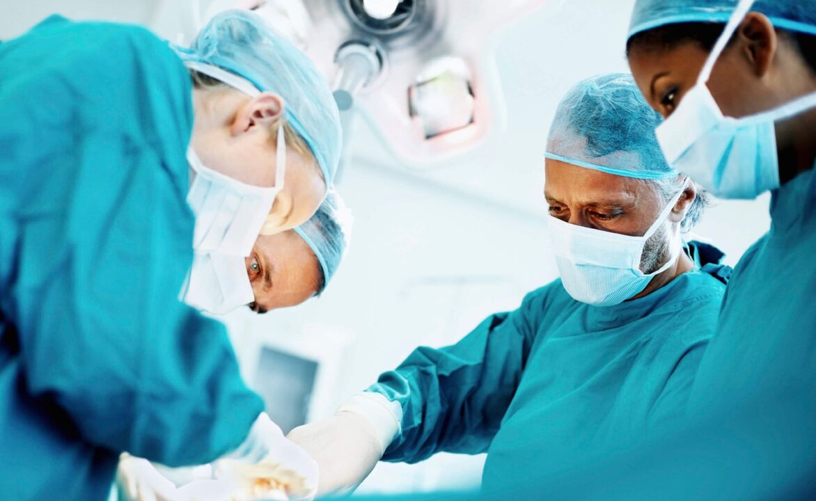 Процесът на уголемяване на пениса от хирурзи чрез операция